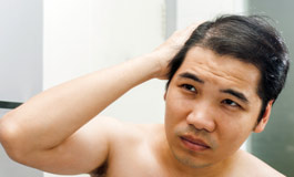 علت و درمان ریزش مو در مردان