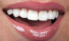 لمینت دندان یا ارتودنسی