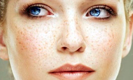لیزر لک صورت و جوانسازی پوست