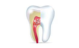 عصب کشی مجدد دندان