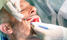 خطرات عصب کشی دندان