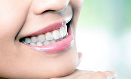 لمینیت دندان ها در ایران