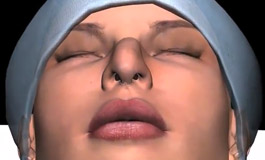 جراحی زیبایی بینی