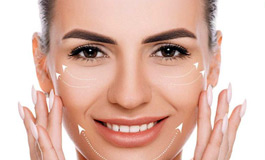 انواع نخ ها برای لیفت گونه